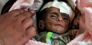 Comment la famine a-t-elle frappé l’Afrique de l'Est?