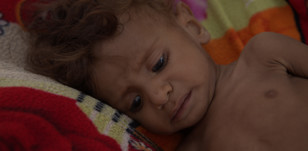Yémen : Un pays rongé par la crise sanitaire 